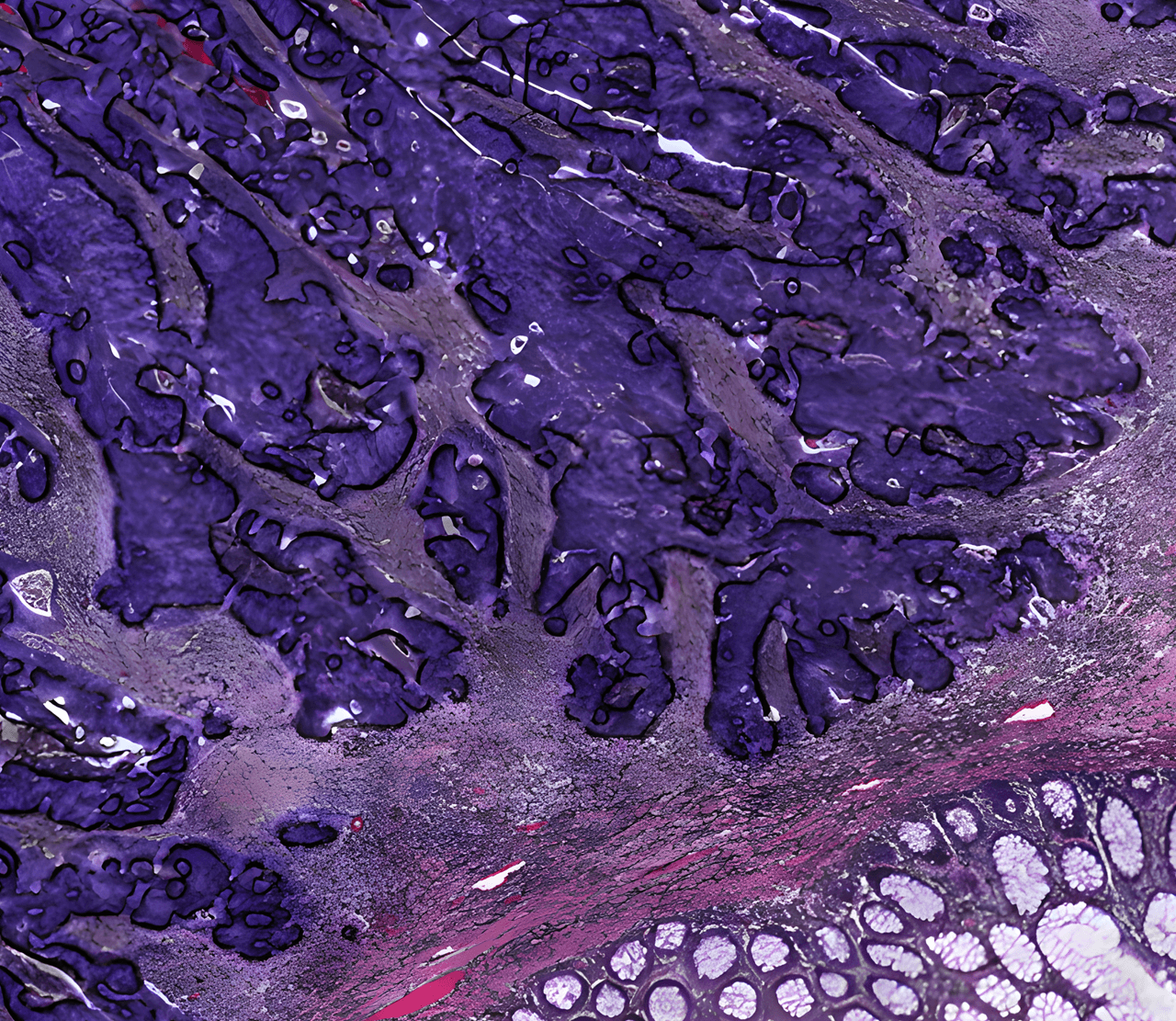 Precision mask applied over the annotated tissue